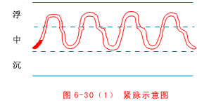 Tight Pulse