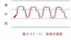 Wiry Pulse